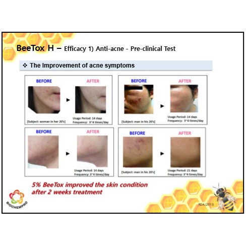 10ML HOẠT CHẤT BEE TOX H