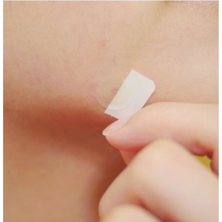 Miếng dán mụn Derma Angel dùng cho ban đêm  15g