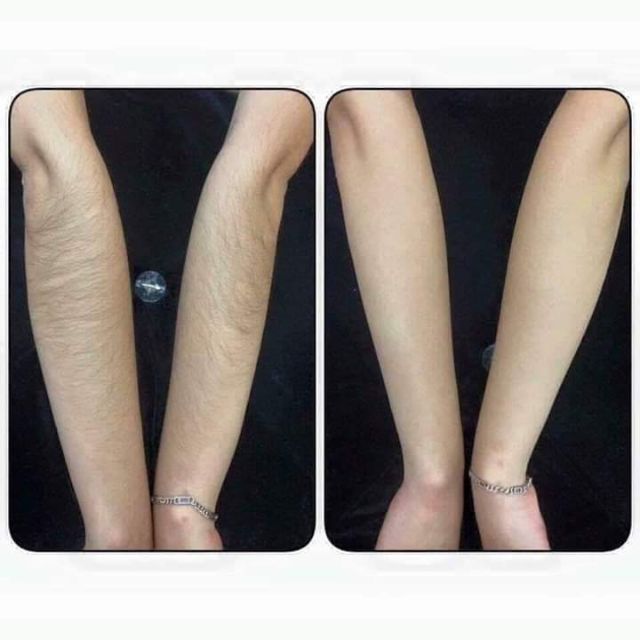 (MUA 1 tặng1 SERUM CAO TRIỆT) Kem triệt râu lông tận gốc vĩnh viễn thảo dược thiên nhiên | BigBuy360 - bigbuy360.vn