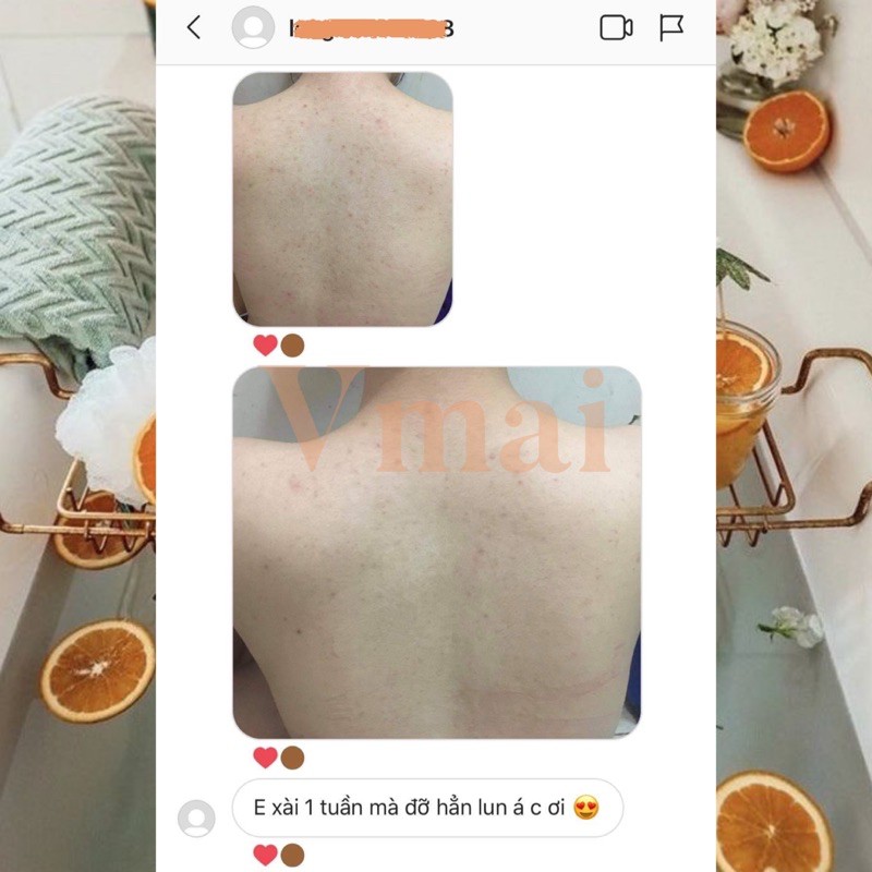 Xà phòng Gluta C Soap dưỡng trắng đẩy lùi thâm mụn | BigBuy360 - bigbuy360.vn