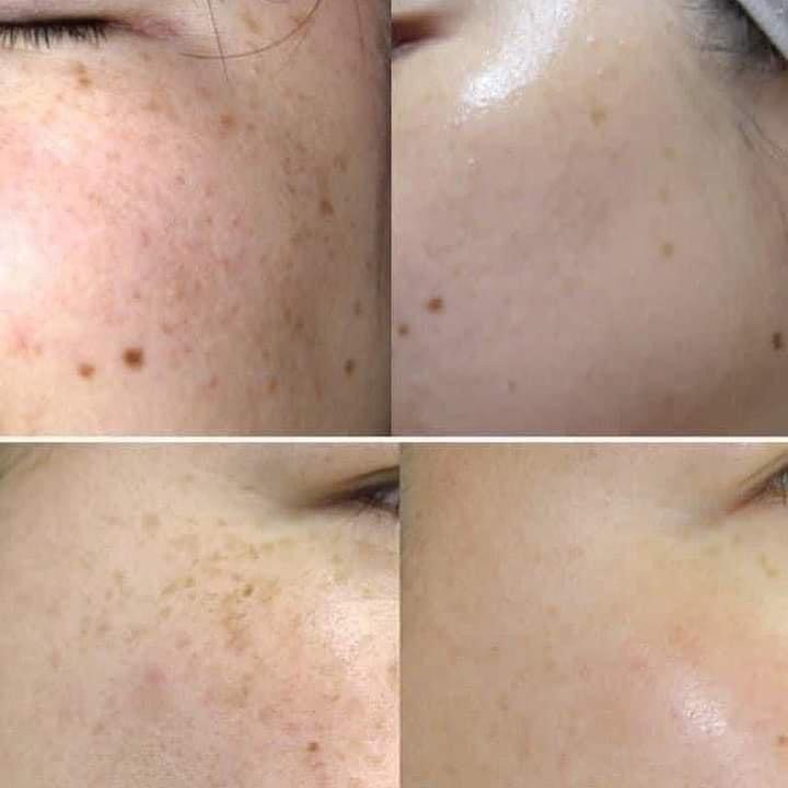 Kem Nám DongSung Miskos Prestige Whitening Cream 50g