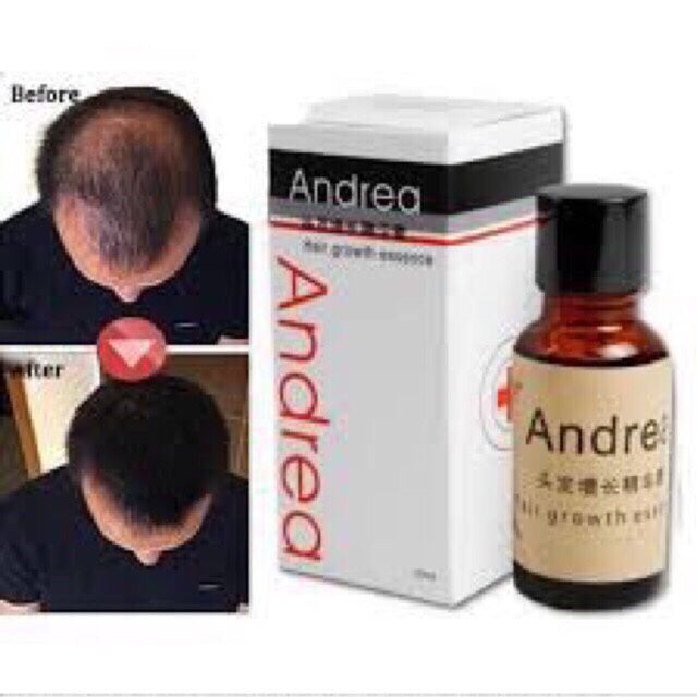Serum kích mọc tóc Andrea