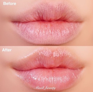 Son dưỡng môi Carmex Classic Lipbalm SPF15