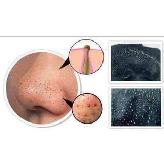 Miếng dán lột mụn đầu đen KOSE