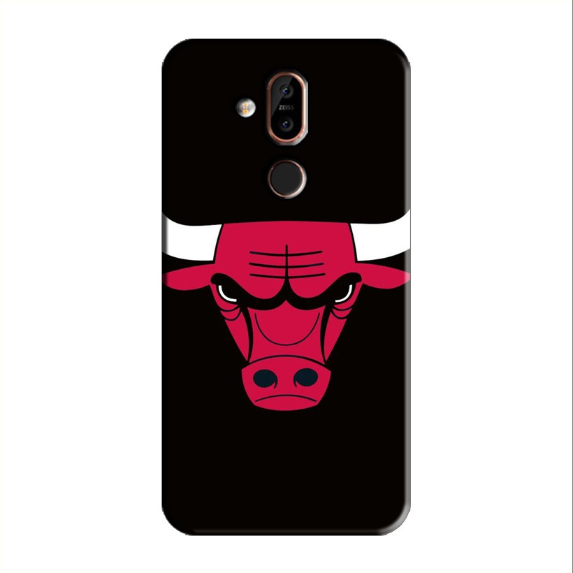 ỐP LƯNG NOKIA 7.1 PLUS/X7/8.1