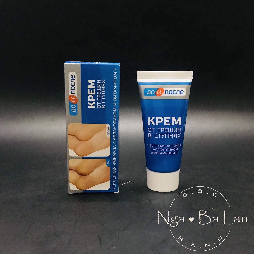 kem giảm nứt gót chân kpem Nga 50ml
