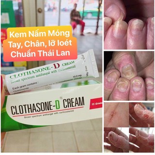 [CHỈ BÁN HÀNG THÁI] KEM DƯỠNG NẤM DA TAY THÁI LAN [SẴN][FREESHIP][CHUẨN HÀNG][BẢO HÀNH 7 NGÀY]