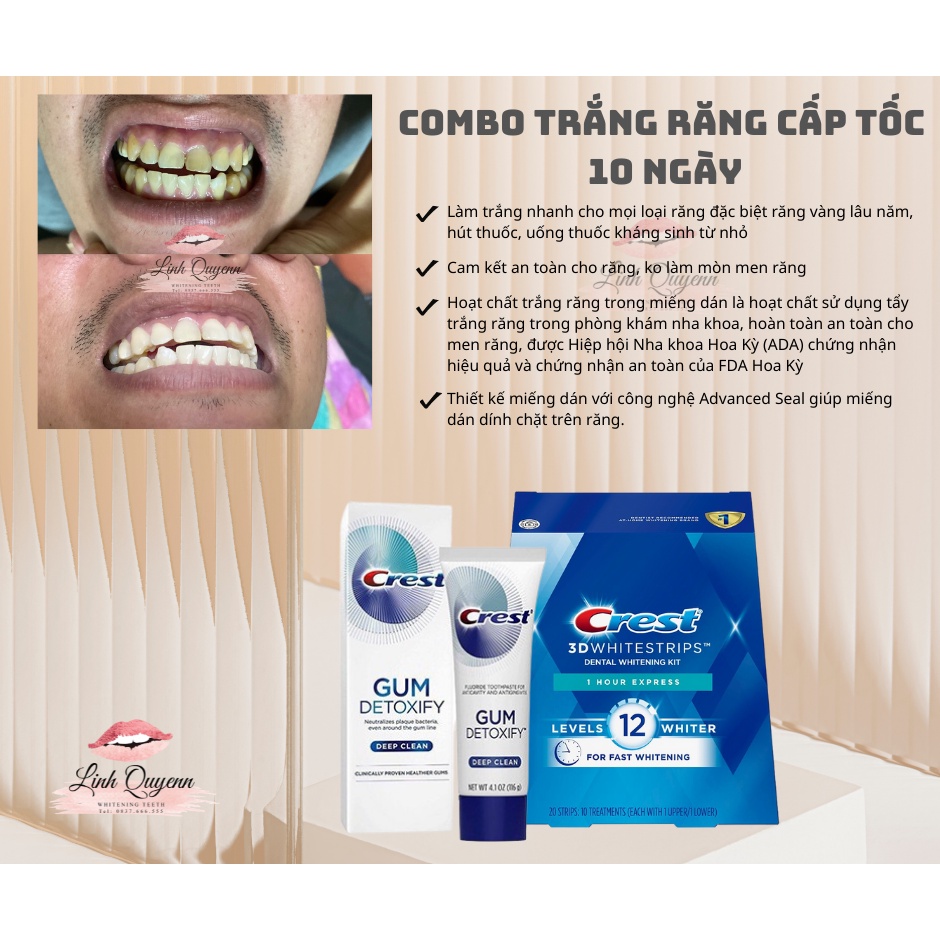 Miếng Dán trắng răng Crest cấp tốc sau 1 giờ Fullbox - 1 Hour Express