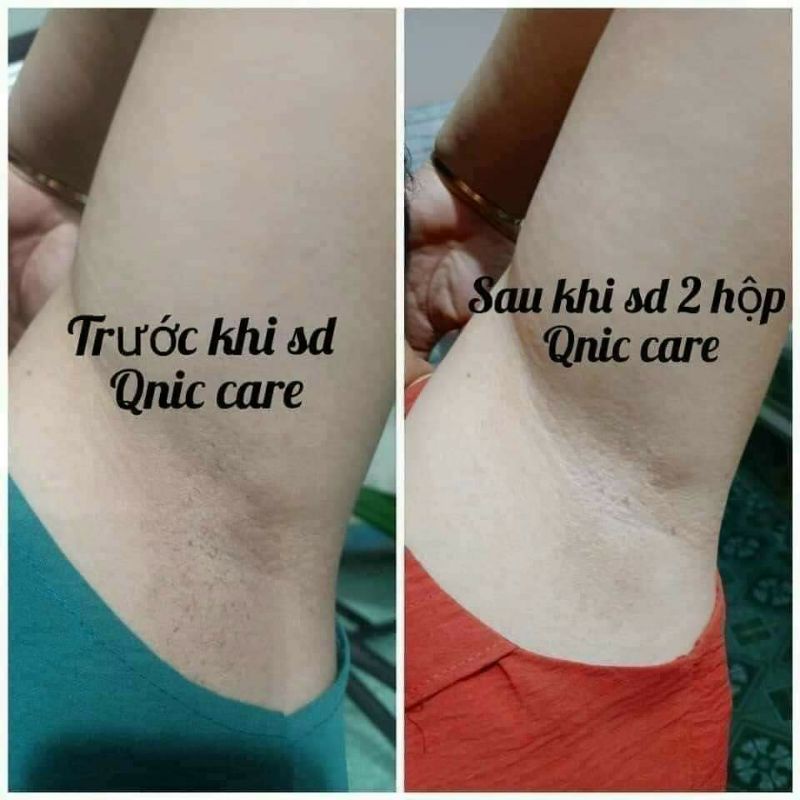 Hũ trắng nách Q-nic Care Thái lan