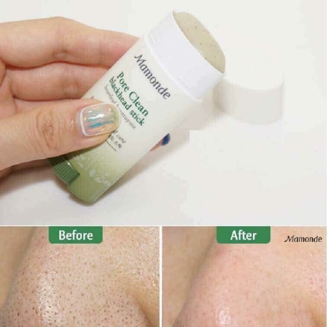 Thanh lăn mụn đầu đen Mamonde