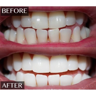 Bột Trắng Răng Eucryl 50g Anh Quốc