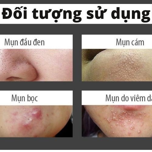 Bột rửa mặt thảo dược Thông Cát làm đẹp da, giảm mụn, dưỡng da trắng sáng, loại bỏ tế bào chết và tái tạo da hiệu quả
