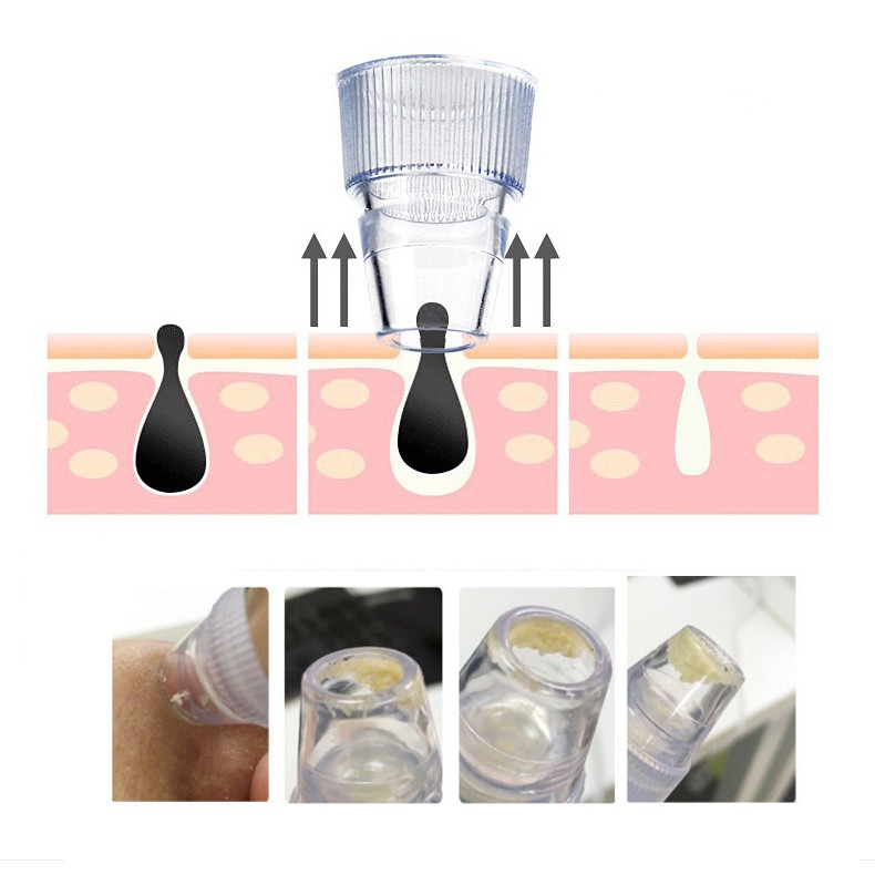 [Hàng Loại 1] Máy Hút Mụn RT8080,8030 Siêu Sạch Với  Cấp Độ Làm Căn Da Xóa Nếp Nhăn - Màu Hồng Da | BigBuy360 - bigbuy360.vn