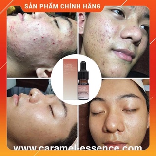 Tinh Chất CARAMEL ESENCE Hãng Nhật Bản