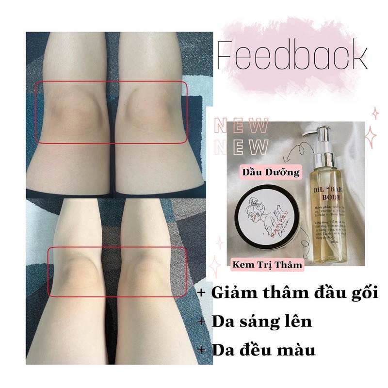 Combo Babi [ Kem dưỡng + Oil 100ml ]