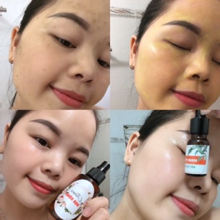 Combo chăm sóc da mặt thiên nhiên HandMade