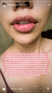 ❤️ SON SIÊU DƯỠNG CARMEX CLASSIC LIP BALM MEDICATED ❤️