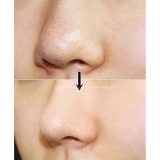 𝐍𝐮̛𝐨̛́𝐜 𝐇𝐨𝐚 𝐇𝐨̂̀𝐧𝐠 INNISFREE 𝐉𝐄𝐉𝐔 𝐕𝐎𝐋𝐂𝐀𝐍𝐈𝐂 𝐏𝐎𝐑𝐄 𝐓𝐎𝐍𝐄𝐑 𝟐𝐗