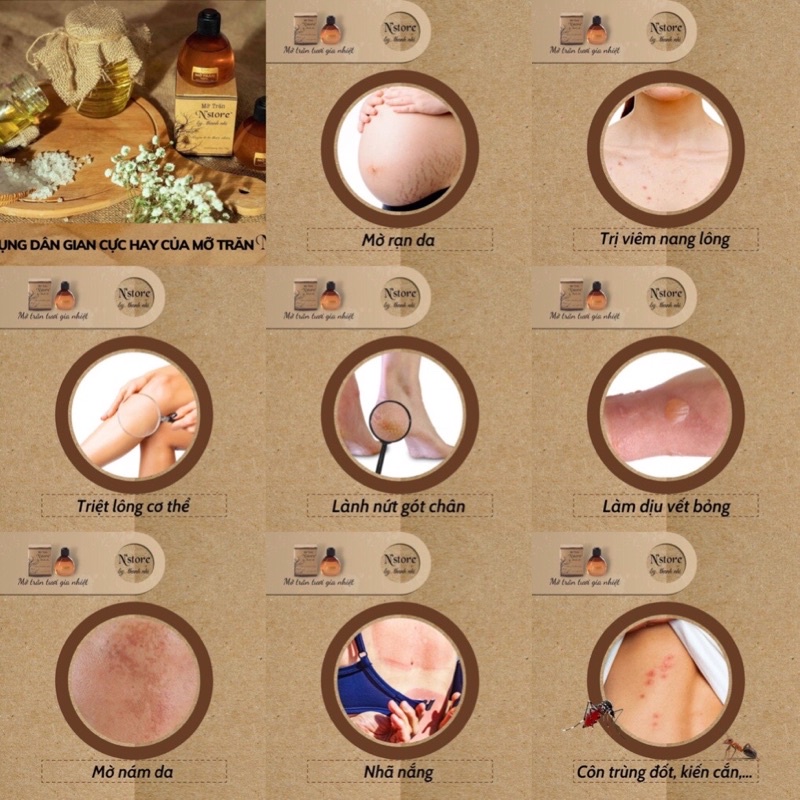 Combo nồi chông dính ceramic sáp và mỡ trăn n’store giúp tẩy sạch lông nách , râu , bikini , tay , chân