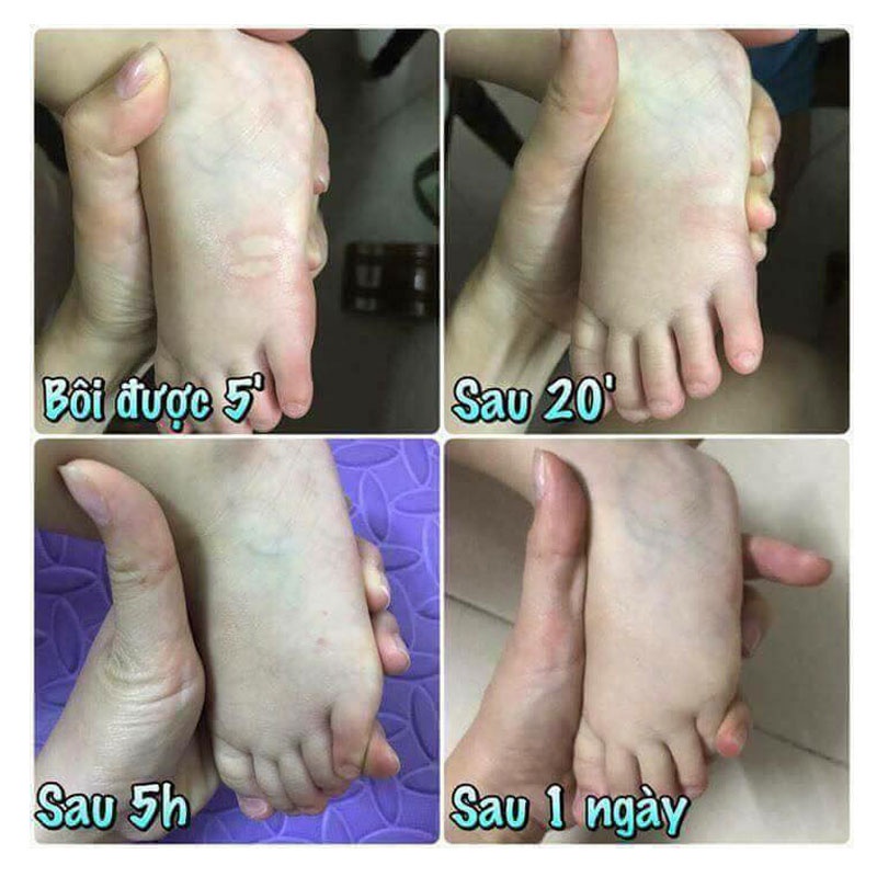 Dầu Đuổi Muỗi Đốt Thái Lan - Bôi Vết Muỗi Đốt, Côn Trung Cắn - Chống Muỗi Và Côn Trùng - DBM01 - Gia Dụng Tý Tẹo