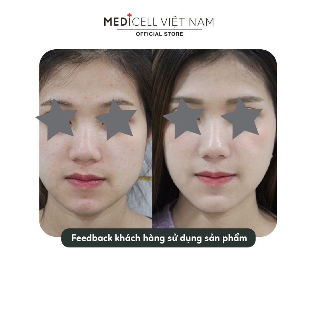 Serum Ultra White Detox Serum Medicell, dưỡng trắng, thải độc cho da - Chai 30ml