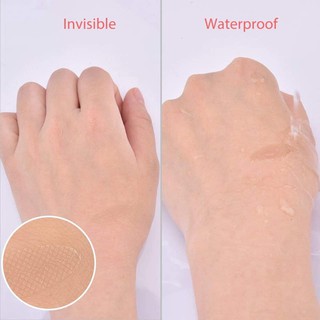 Kích mí lưới cuộn