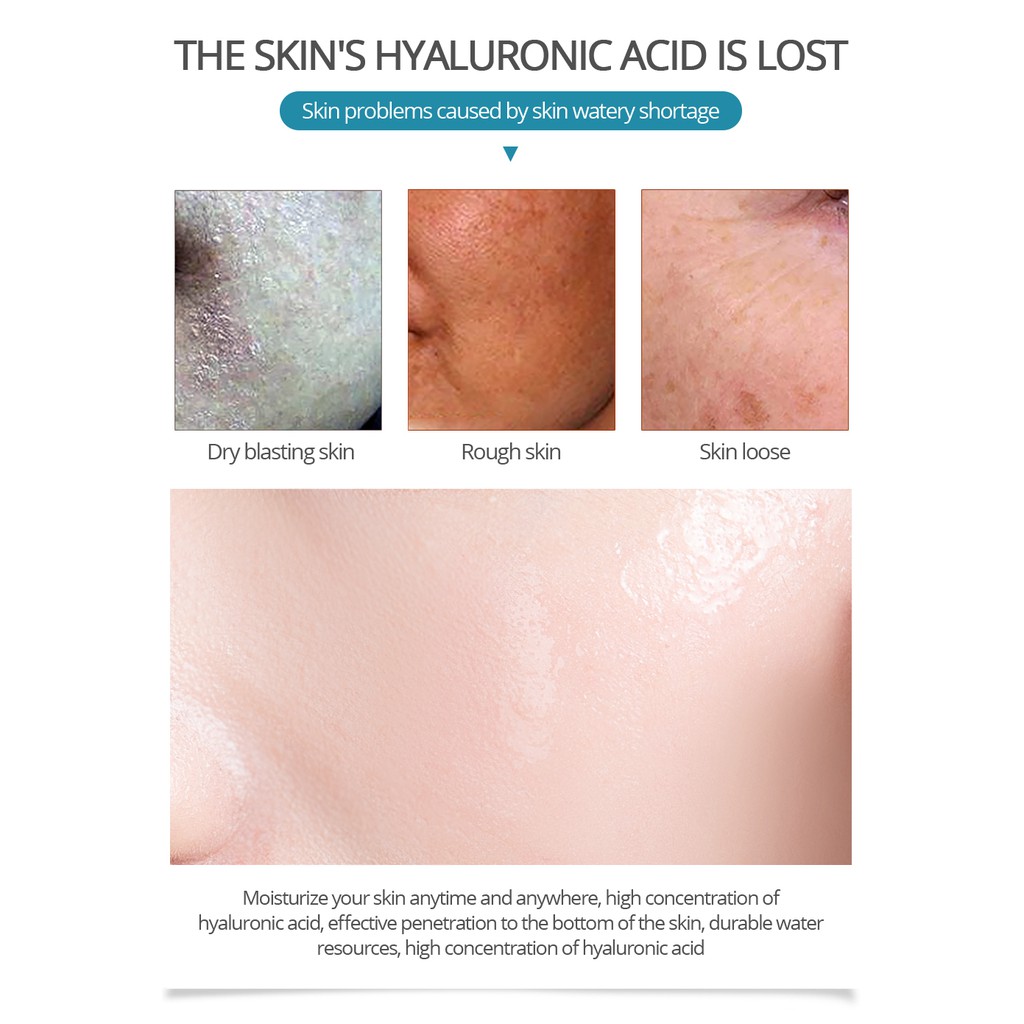 Tinh chất axit hyaluronic dưỡng ẩm hỗ trợ giảm mụn làm trắng da chống lão hóa dung tích 5ml | BigBuy360 - bigbuy360.vn