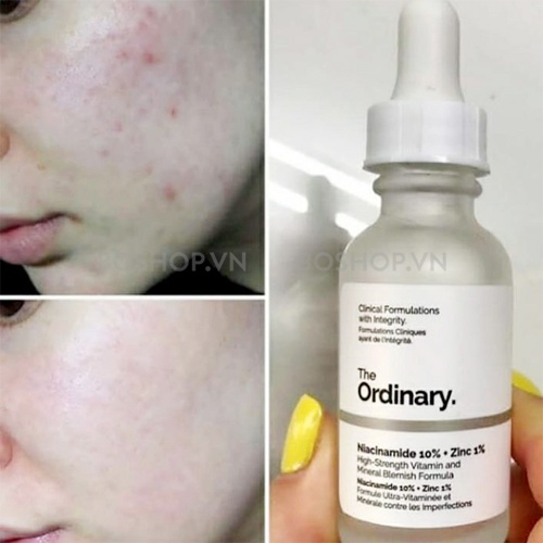 Serum Kiềm Dầu Mờ Thâm Mụn The Ordinary Niacinamide 10% + Zinc 1% 30ml