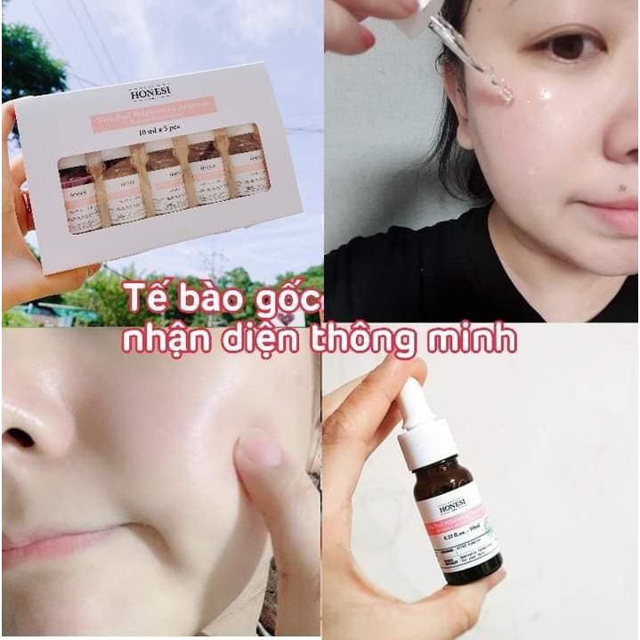 Tinh chất tế bào gốc xóa nám, kích trắng Honesi Vita Peel Brightening Ampoule Hàn Quốc