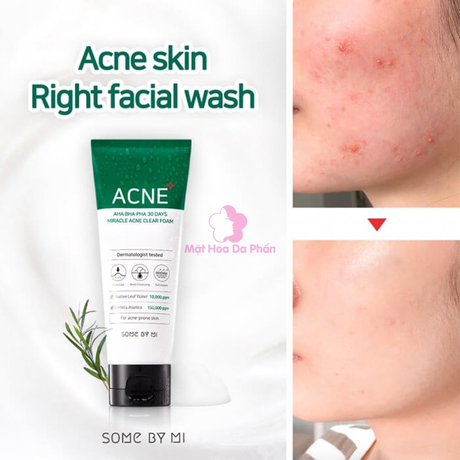 Sữa rửa mặt làm sạch mụn cho da mụn,da dầu acne some by mi aha-bha-pha 30 days miracle acne clear foam 100m skin hub