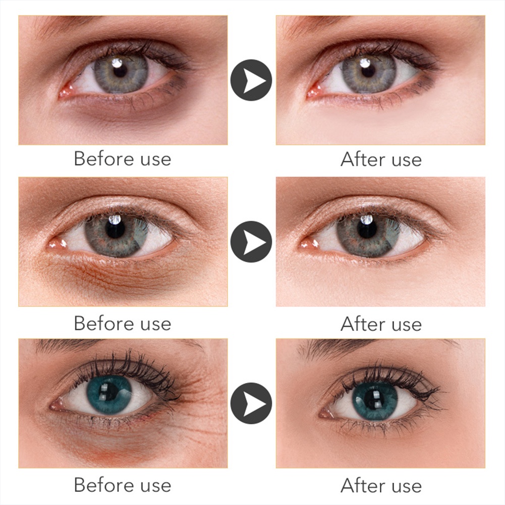 Serum Vitamin C Hyaluronic Acid Loại Bỏ Quầng Thâm Và Bọng Mắt Làm Sáng Da