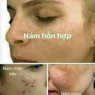 Mỹ phẩm cao cấp clobetamin g