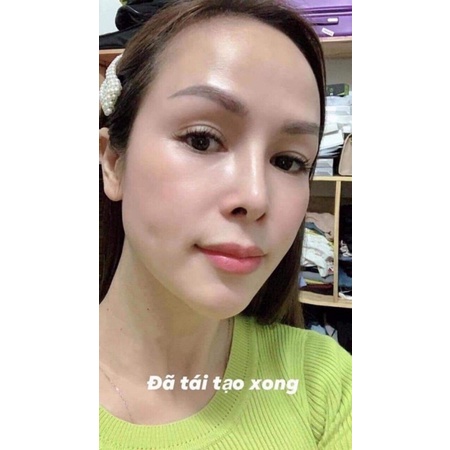 5 HỘP KEM CHAMOMILESKILL