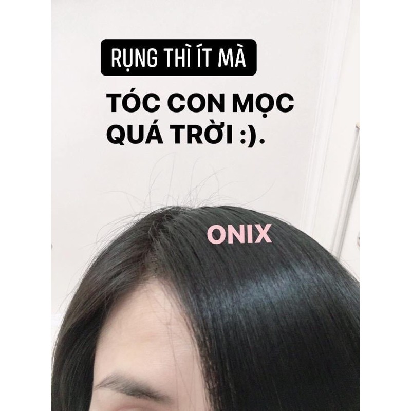 Dầu gội thảo mộc ONIX sạch gàu, giảm rụng, mọc tóc, thơm sảng khoái | BigBuy360 - bigbuy360.vn