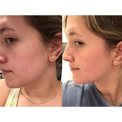 [AUTH - ĐỦ BILL] Serum làm sáng da SkinCeuticals C E Ferulic 4ml