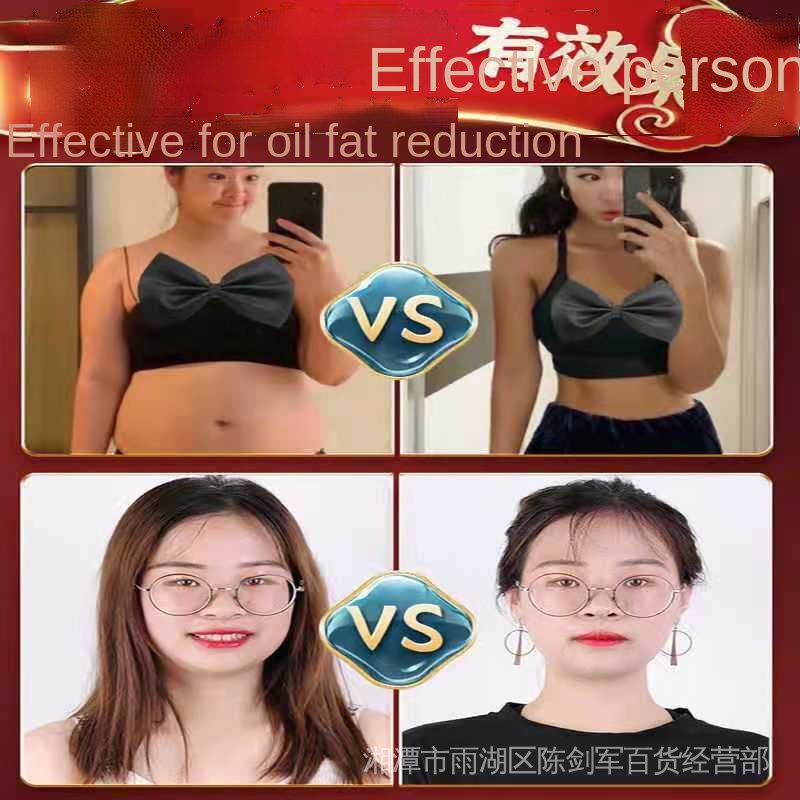 Miếng dán dạng viên Nanjing Tongrentang Moxa hỗ trợ thon gọn cơ thể hiệu quả