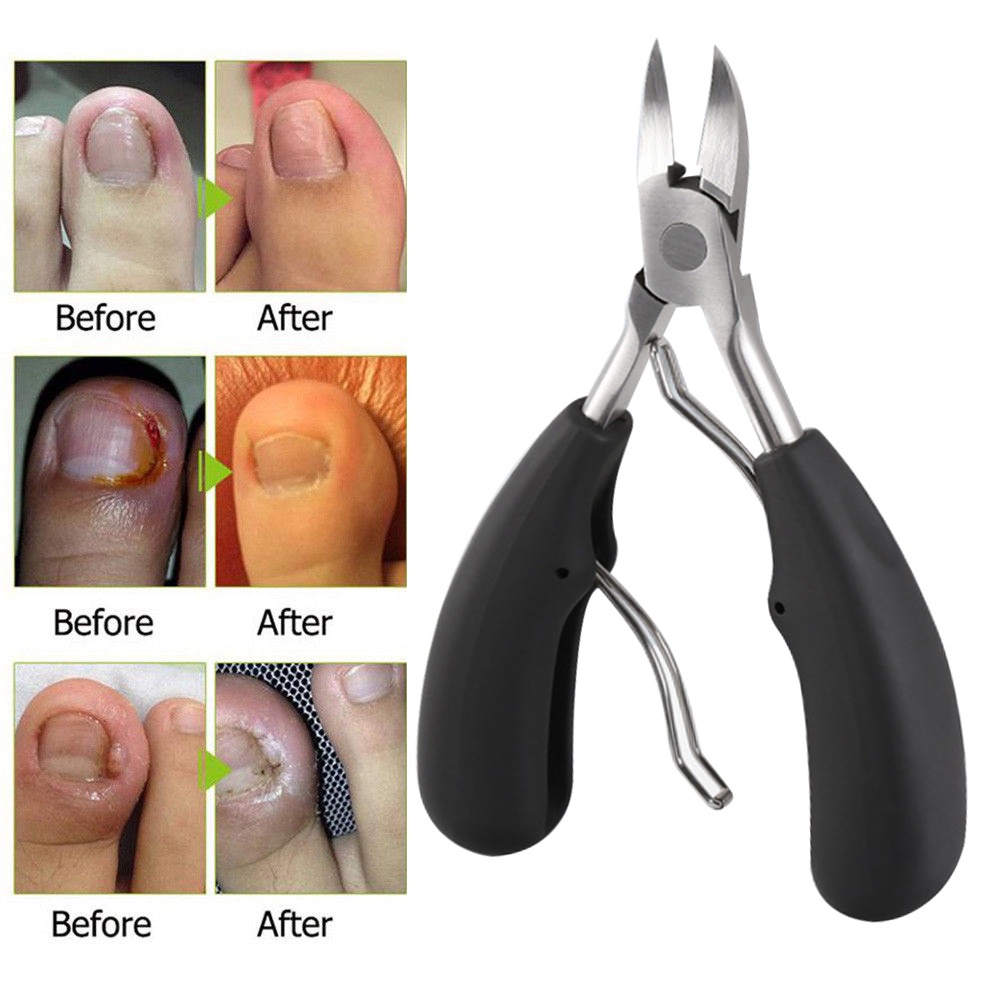 Kềm Cắt Móng Chân / Móng Chân Bằng Thép Không Gỉ Chuyên Nghiệp Hoàn Hảo Cho Móng Chân Dày &amp; Ingrown / Kềm Cắt Móng