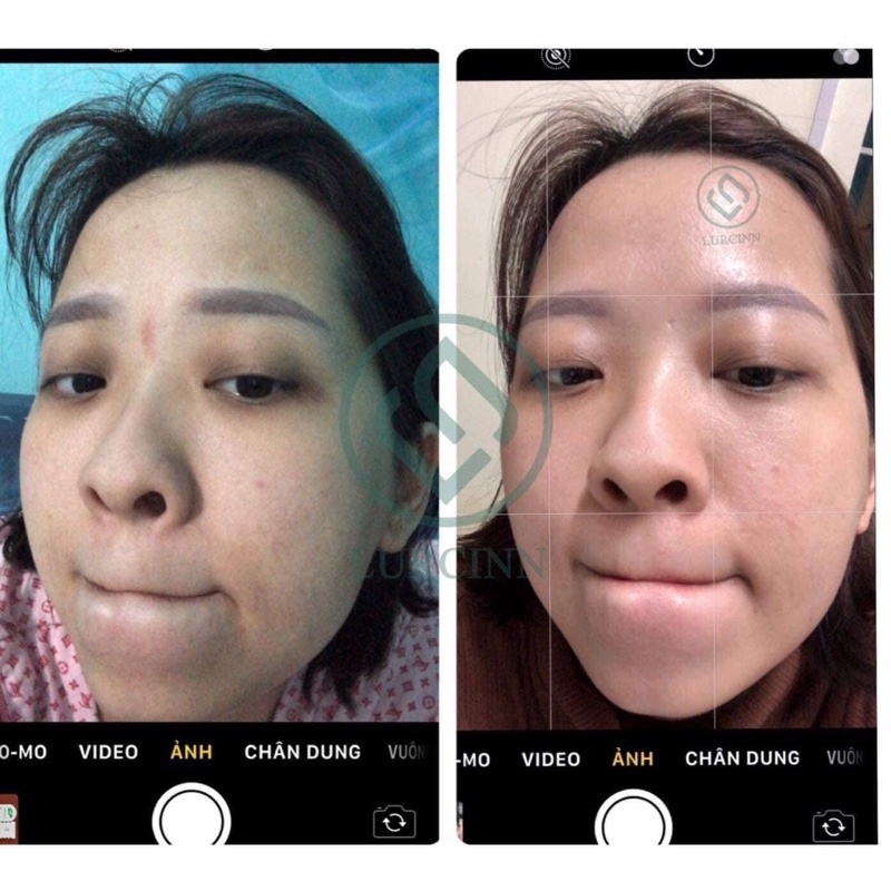 Tế bào gốc 15ml