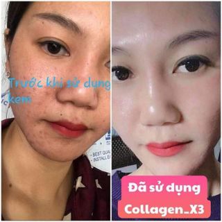 FACE Collagen X3