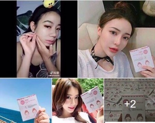 Miếng dân cằm v-line 40k