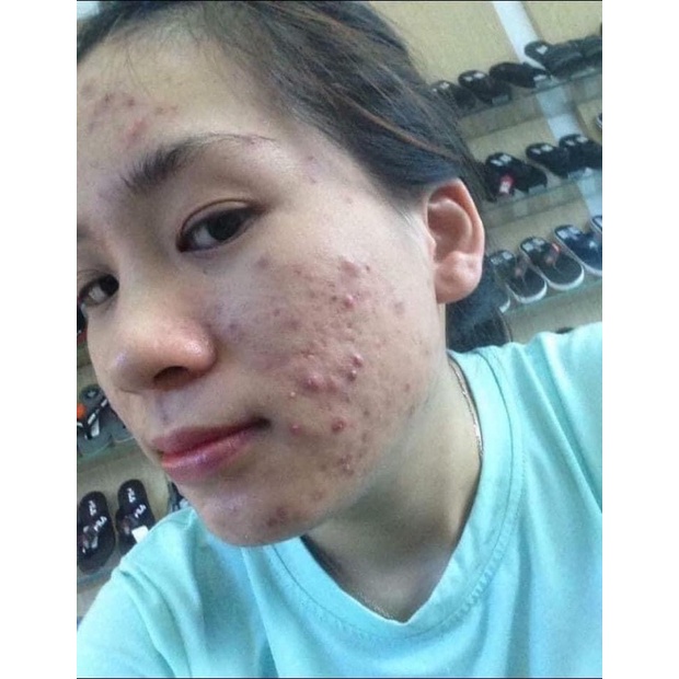 COMBO 2 cốt nhân sâm