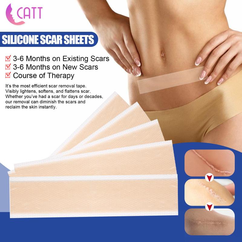 [Dadada1] 4 Miếng Dán Silicone Hỗ trợ giảm sẹo Cho Cơ Thể