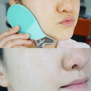 MÁY RỬA MẶT CÁ #WELLDERMA HÀN QUỐC