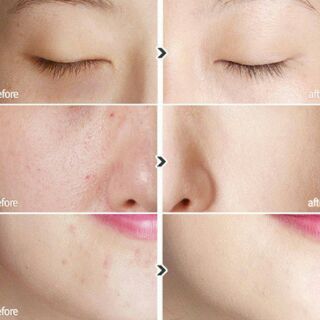 Serum Sakura New Age Perfect Concentrate q10