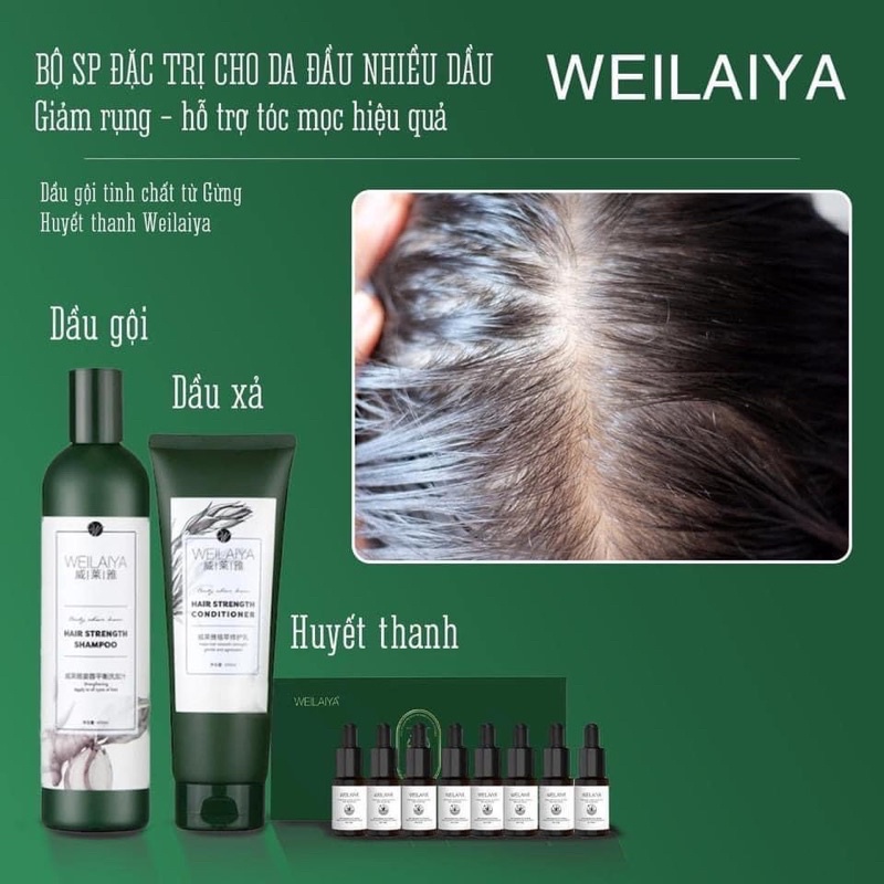 Bộ dầu gội gừng Weilaiya, tinh chất hà thủ ô và gừng tươi, hỗ trợ mọc tóc, ngăn rụng tóc,
