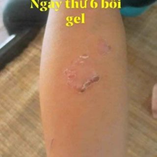 Gel Bôi Da Phú Kang