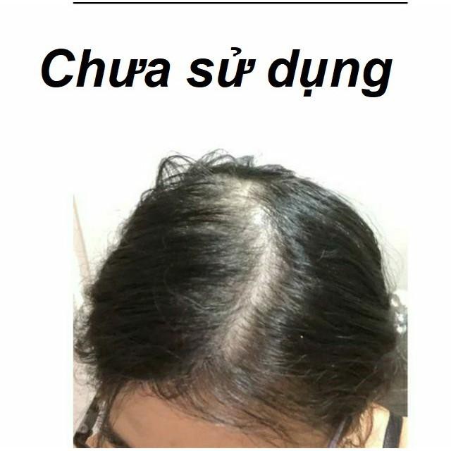 [Bán Sỉ] Bột phủ dày tóc Toppik Hair