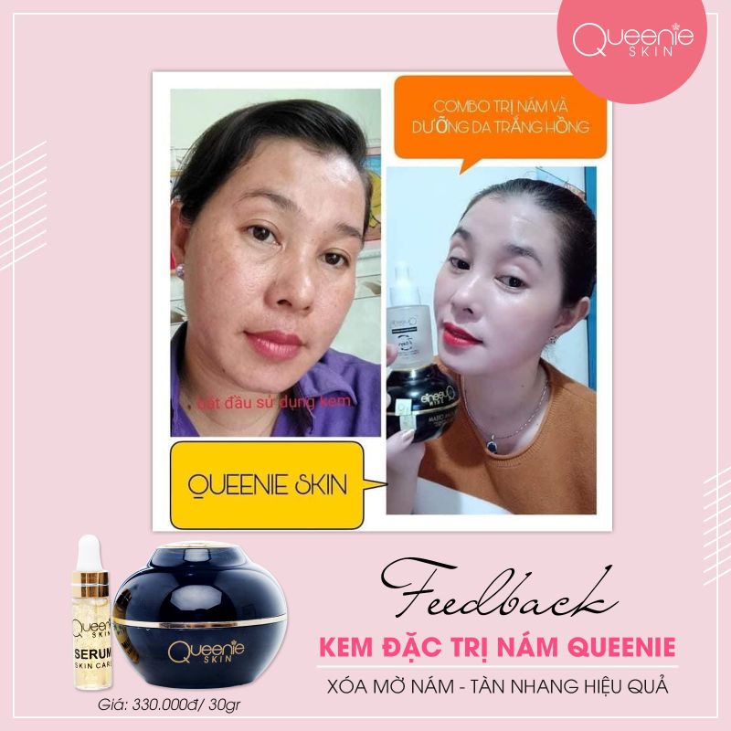 Kem trị_nám, kem dưỡng trắng da chống_lão_hóa mỹ phẩm Queenie Skin tặng kèm serum mini.