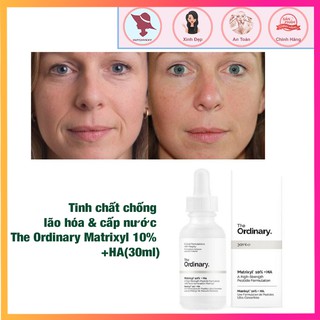 Tinh chất chống lão hóa & cấp nước The Ordinary Matrixyl 10% +HA