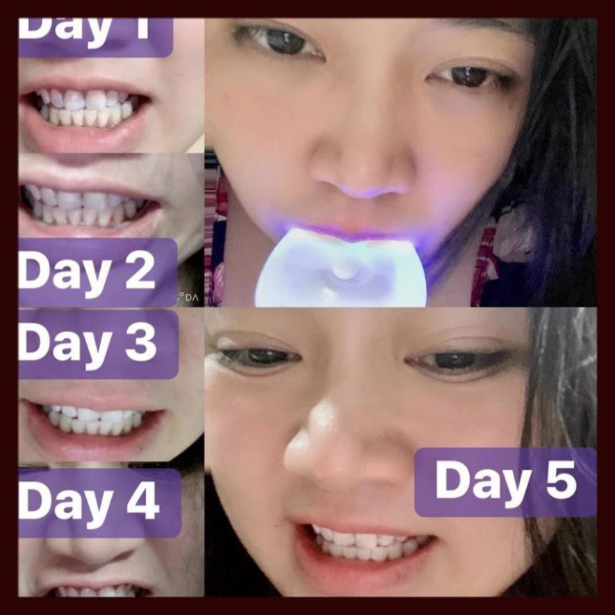 [ Hàng ÚC] Máy làm trắng răng bằng ánh sáng xanh White Glo White Accelerator Blue Light Teeth Whitening System